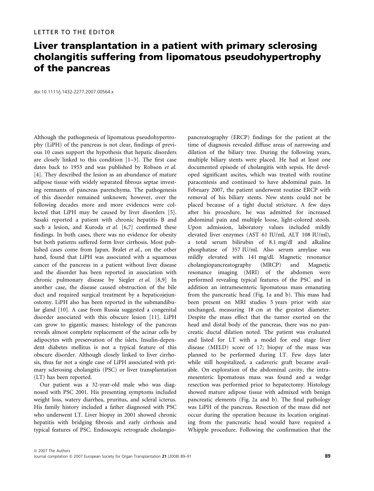 First page of Liver transplantation in a patient with